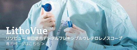 LithoVue™ のご紹介