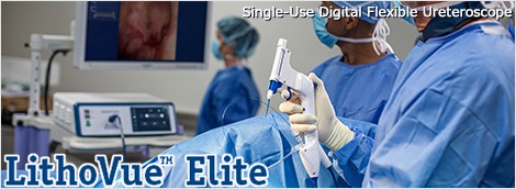 LithoVue™Elite のご紹介