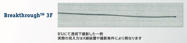 BSJにて透視下撮影した一例 実際の見え方はX線装置や撮影条件により異なります