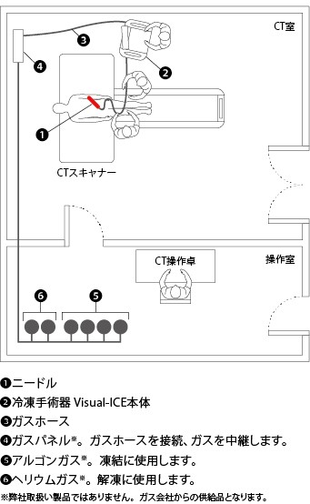 VISUAL ICE™ Cryoablation System　レイアウト例