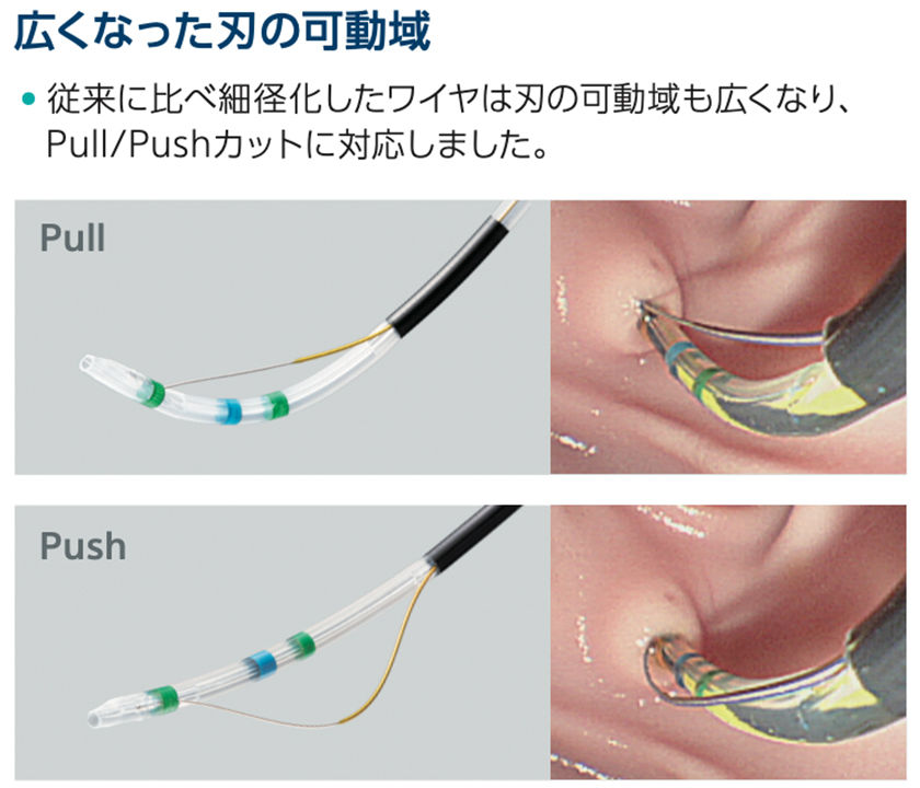 広くなった刃の可動域