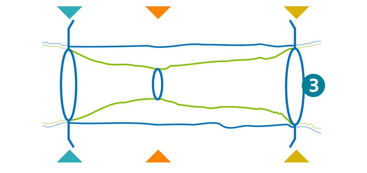 Illustration showing the sideways angle of a lesion and how to gather distal, stenosis and proximal measurements
