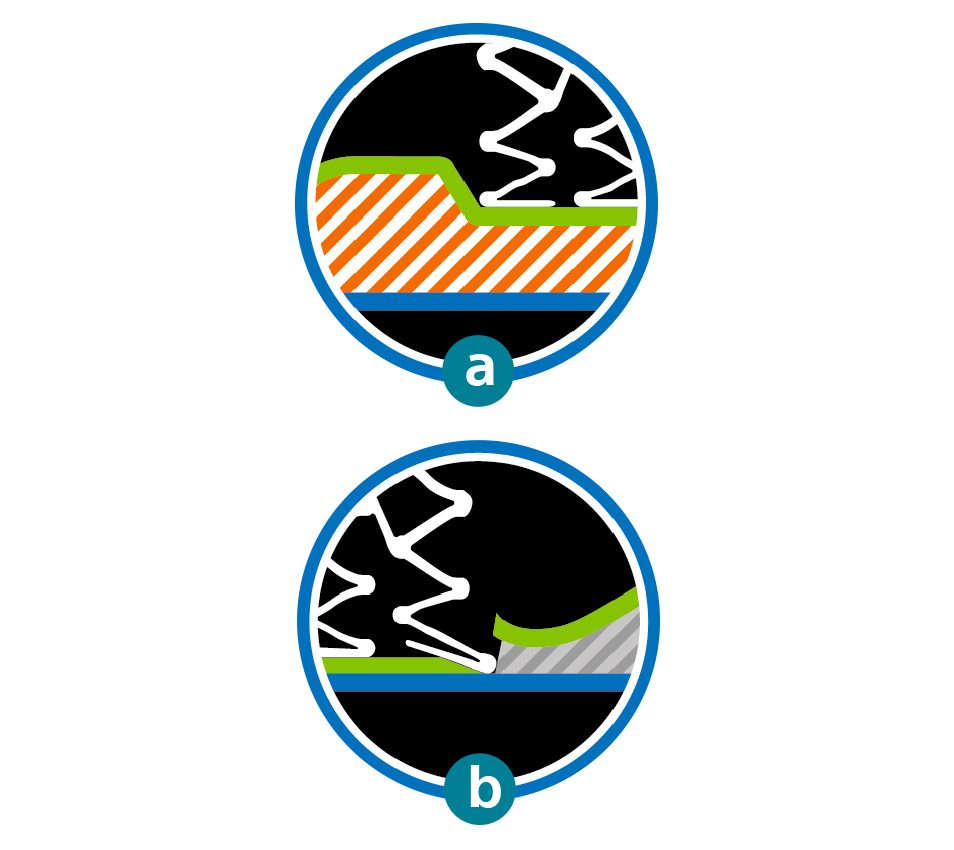 Graphic showing geographic miss of a lesion, Graphic showing edge dissection of a lesion.