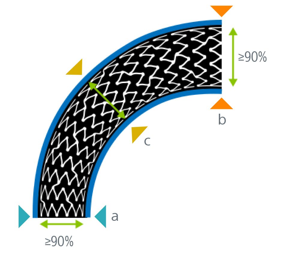 Illustration of a lesion where "a" shows the distal lumen reference, "b" shows the proximal lumen reference, and "c" shows under-expansion.