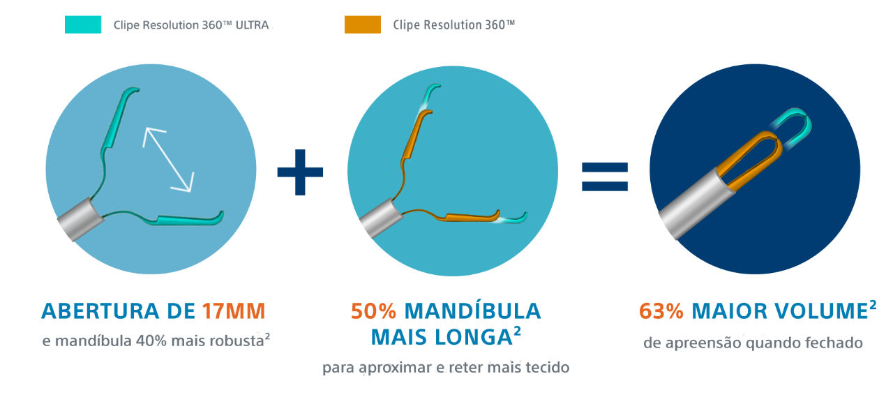 Resolution 360 Clipe Resolution 360™ ULTRA - Boston Scientific