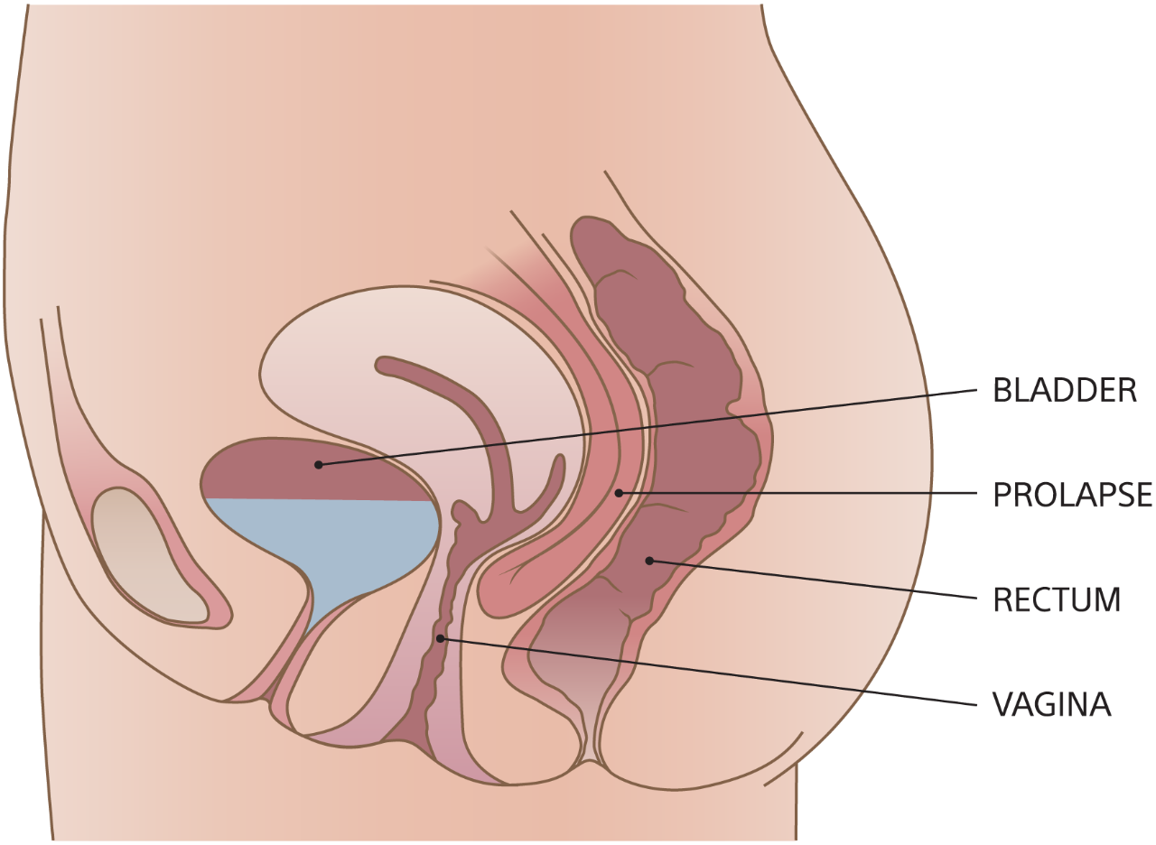 Orifício frontal? Vagina é bem diferente de ânus 