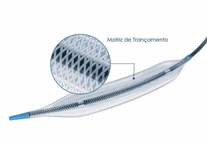 Athletis™ Ultra-High-Pressure Balloon