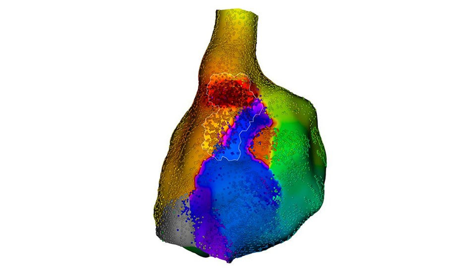opal overview 7
