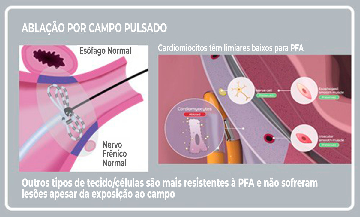 PFA Science and Tissue Labeled Illustration