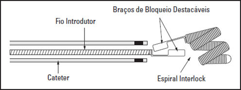 interlock 35 picture1
