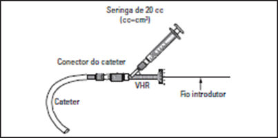 interlock 35 - figura 5 warning