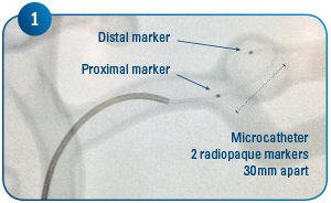 Coil Delivery 1