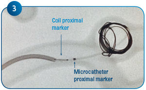 Coil Delivery 3