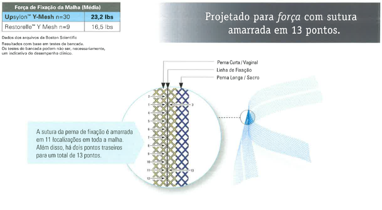 Método e Força da Perna de Fixação