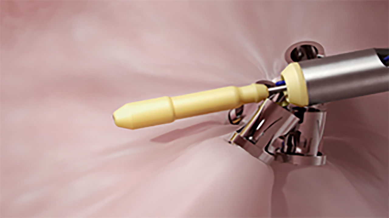 Spyglass Discover distal tip closeup image