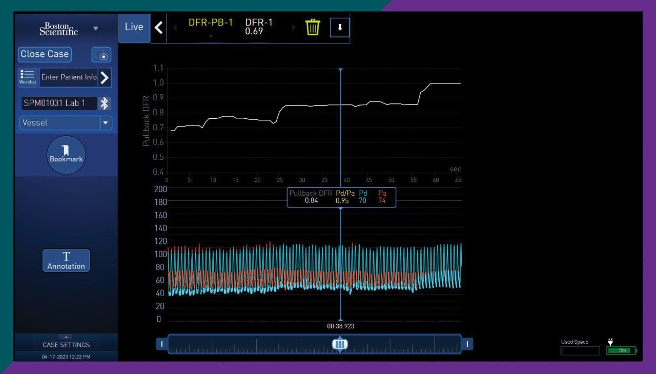 AVVIGO+ PhysioMap software for DFR