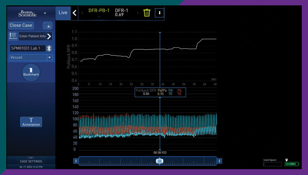 AVVIGO+ PhysioMap software for DFR
