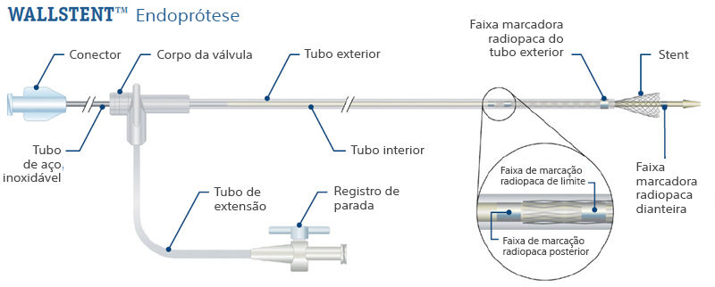 Gráfico Wallstent™