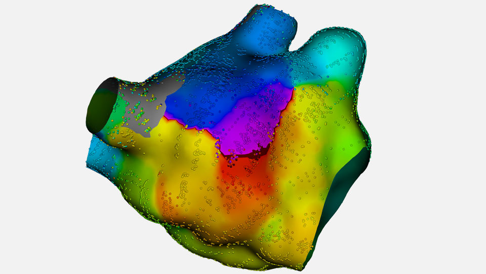Opal overview 2