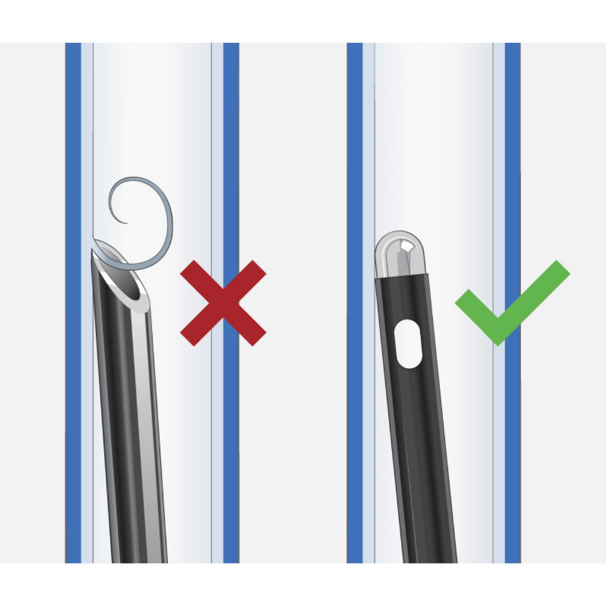 reduce-sckuving