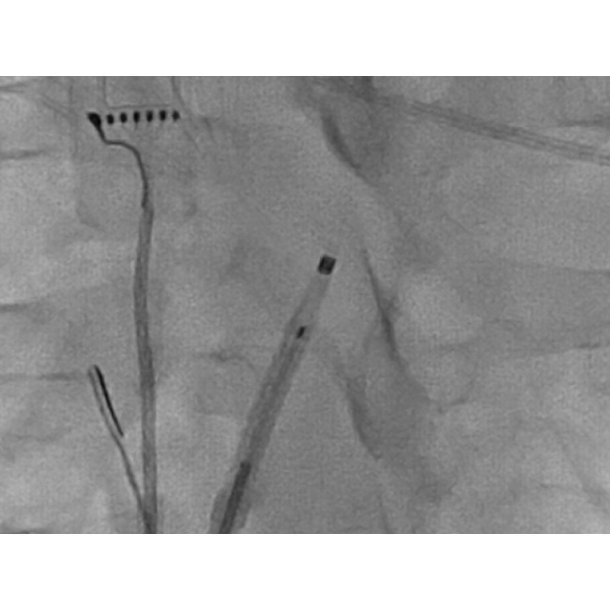 visualize-rf-needle