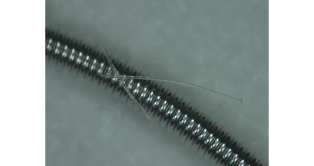 Medtronic Concerto fibers
