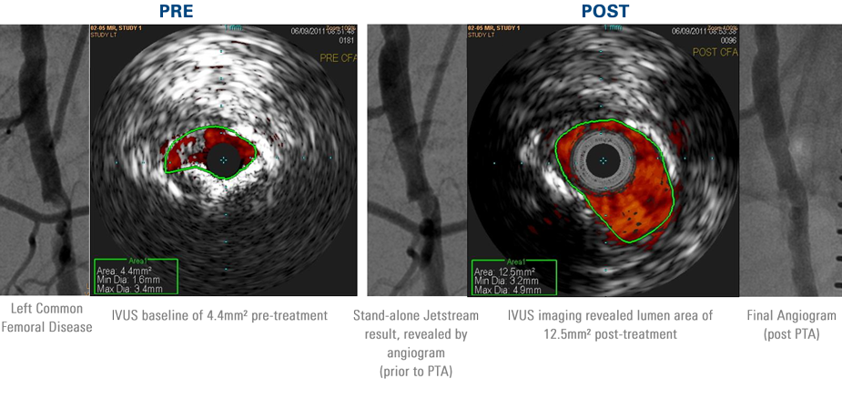 Pre-treatment and Post-treatment images