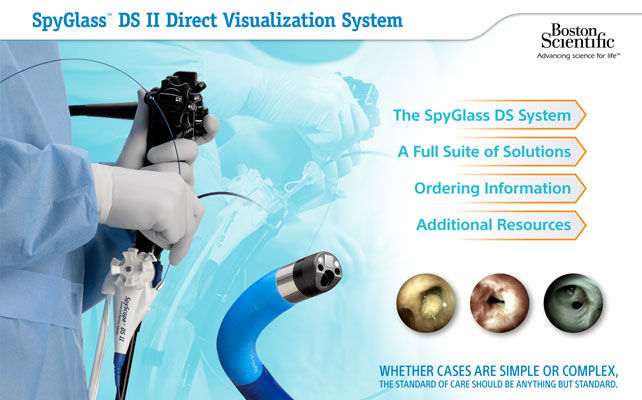 SpyGlass DS System ebrochure