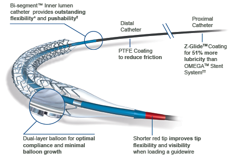 Sistema de Entrega de Stent