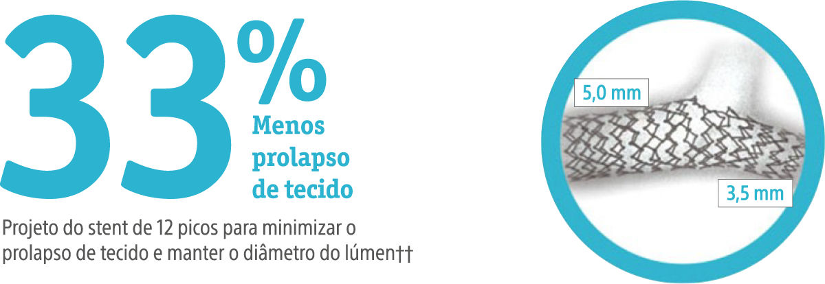 33% less tissue prolapse, 12-peak stent design to minimize tissue prolapse and maintaine lumen diameter