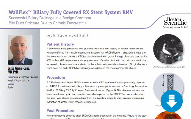 Endoscopic-Management-of-a-Benign-Biliary-Stricture