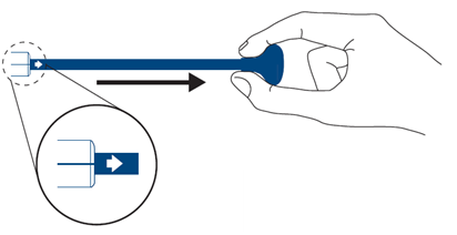 The pull-grip deployment system on the Innova self-expanding stent