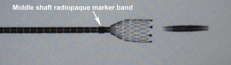 Middle shaft radiopaque marker band - deployment technique of Innova Stent