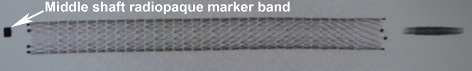 Eluvia Stent deployment technique