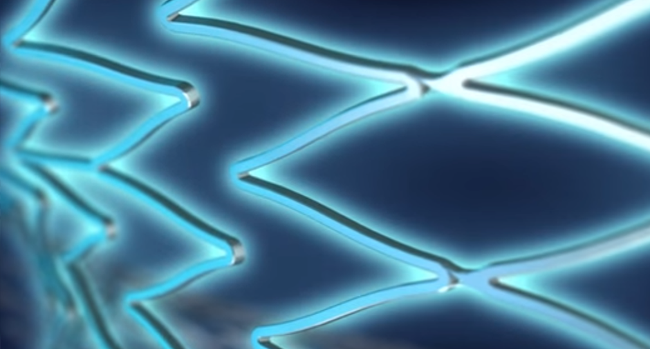 Watch how the Eluvia Drug-Eluting Stent System was designed